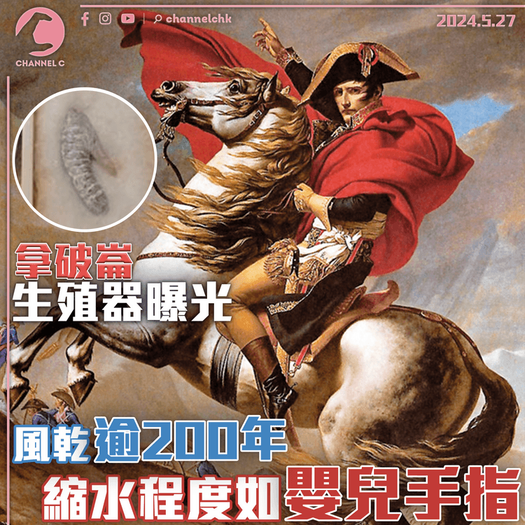 拿破崙生殖器曝光　風乾逾200年　縮水程度嬰兒手指