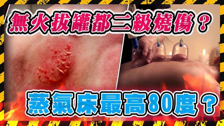 北上按摩慎選！港女拔罐遭二級燒傷 記者親身實測艾床：女仔皮薄燒傷唔出奇 中醫稱有港人因按摩致痙攣 肌肉外露移位