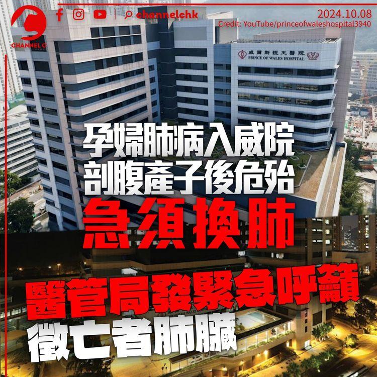 孕婦威院剖腹產子後危殆急須換肺　醫管局發緊急呼籲　血型B+或O+合資格