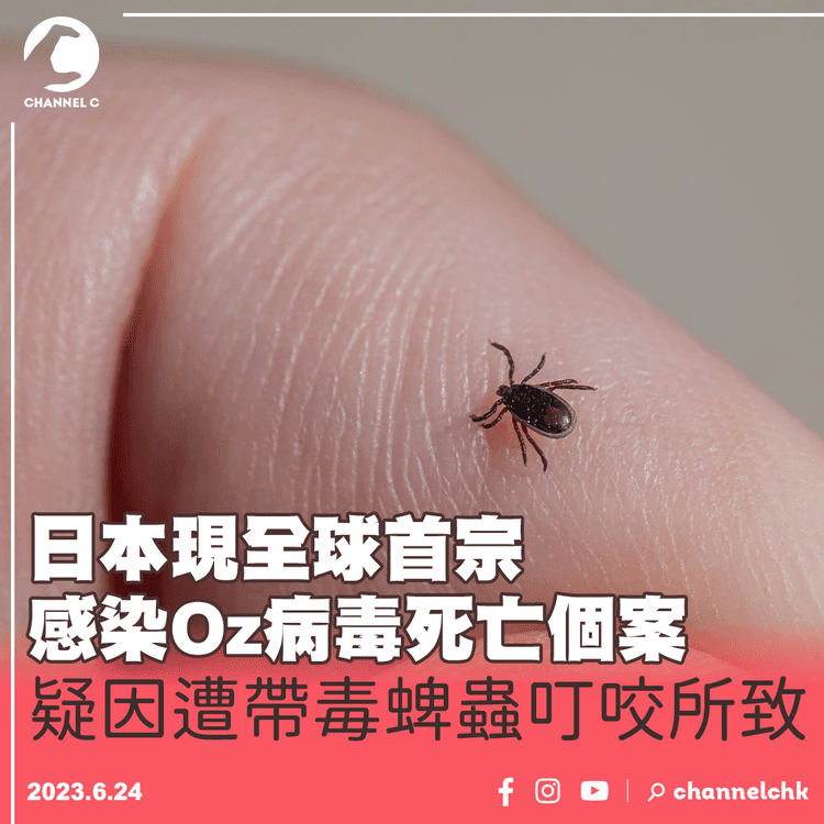 日本現全球首宗感染Oz病毒死亡個案　疑因遭帶毒蜱蟲叮咬所致