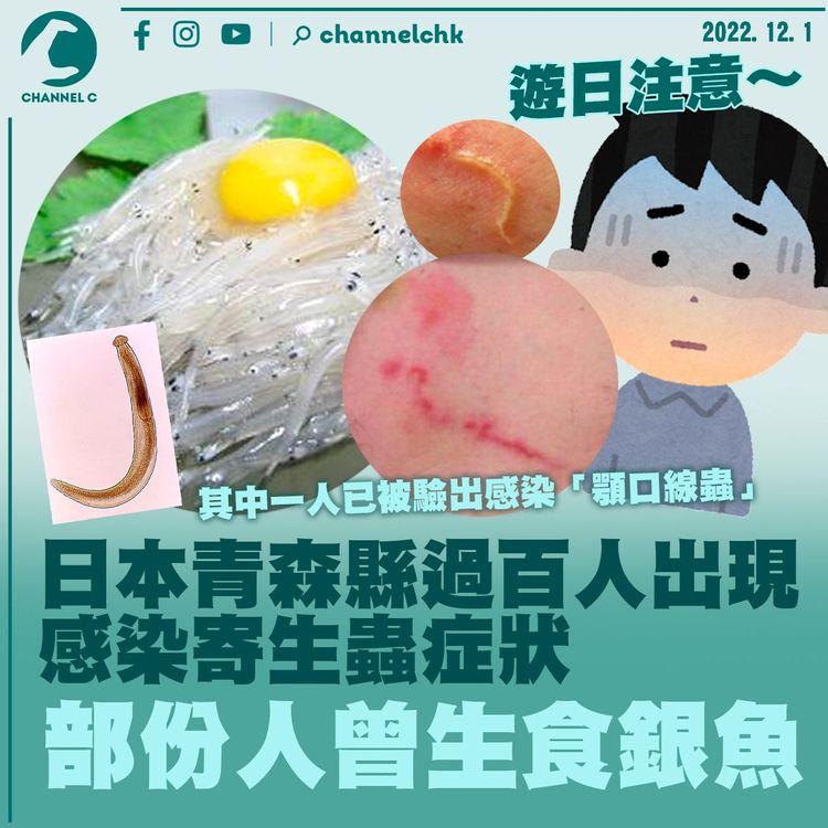 日本青森縣過百人出現感染寄生蟲症狀 部份人曾生食銀魚