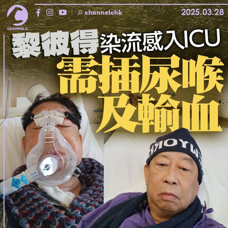 黎彼得染流感入ICU　需插尿喉及輸血