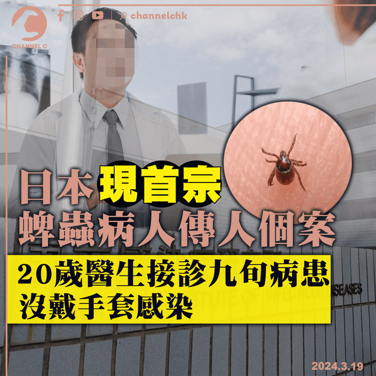 日本現首宗蜱蟲病人傳人個案　20歲醫生接診九旬病患　沒戴手套感染