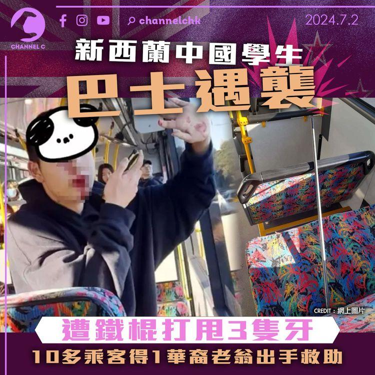 新西蘭中國學生巴士遇襲　遭鐵棍打甩3隻牙　10多乘客得1華裔老翁出手救助