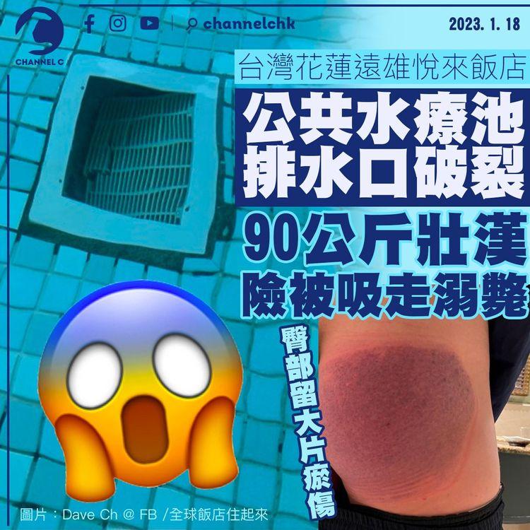台灣酒店水療池排水口破裂 90公斤壯漢險被吸走溺斃 臀部留大片瘀傷