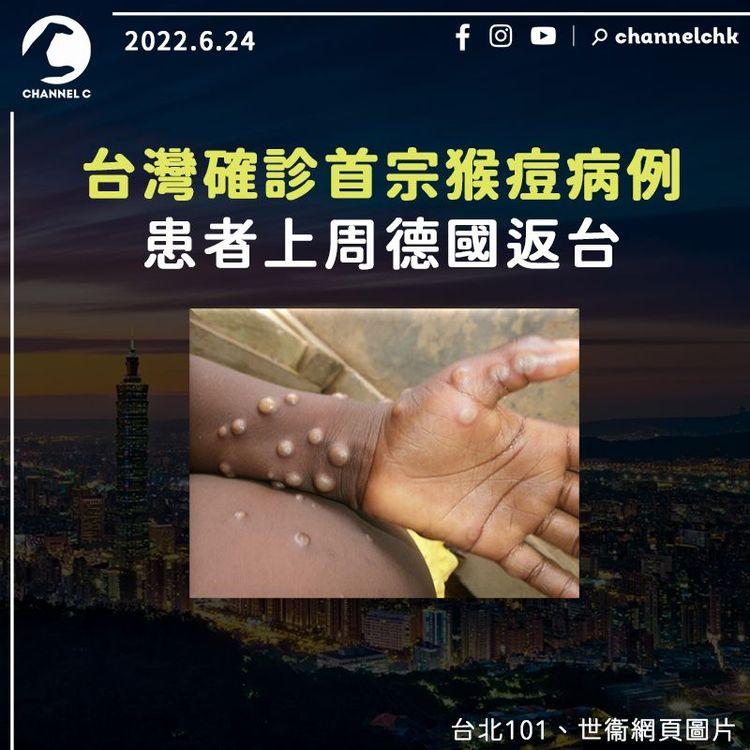 台灣確診首宗猴痘例 患者上周德國返台 