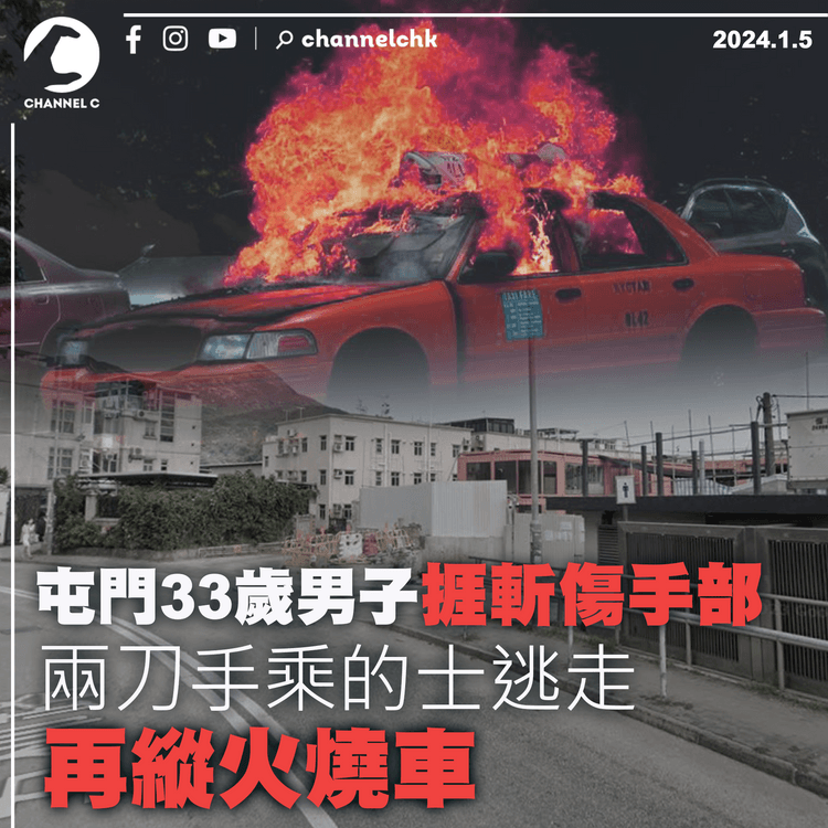 屯門33歲男子捱斬傷手部　兩刀手乘的士逃走　再縱火燒車