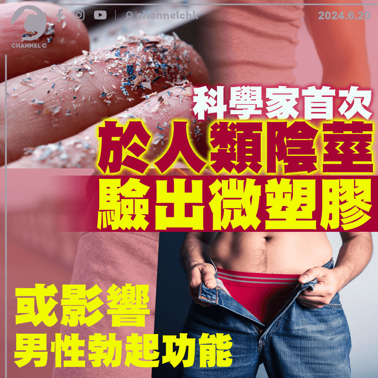 科學家首次於人類陰莖驗出微塑膠　或影響男性勃起功能