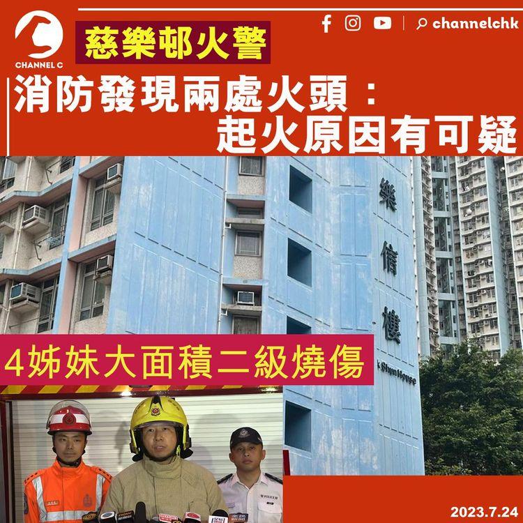 慈樂邨火警　消防發現兩處火頭：起火原因有可疑　4姊妹大面積二級燒傷