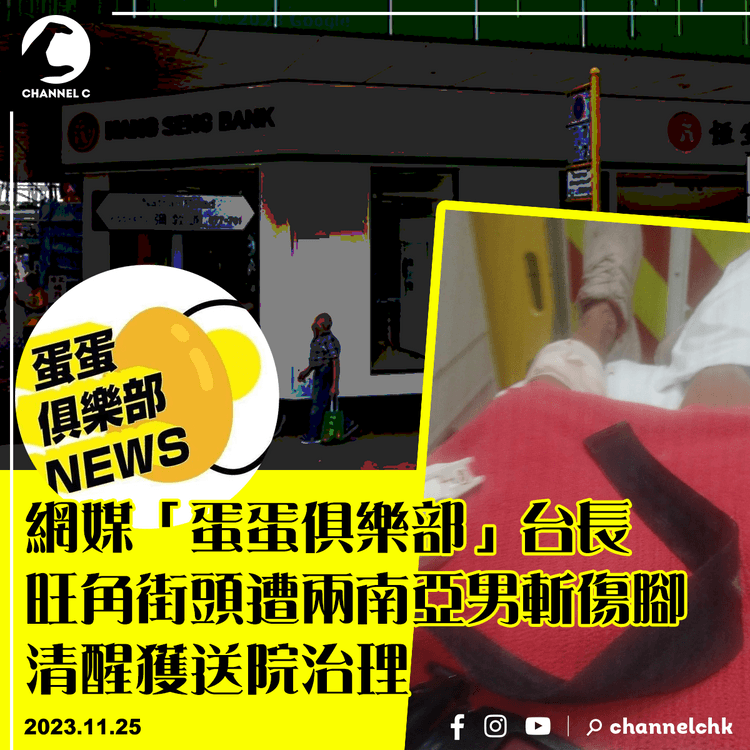 網媒「蛋蛋俱樂部」台長旺角街頭遭兩南亞男斬傷腳　清醒獲送院治理