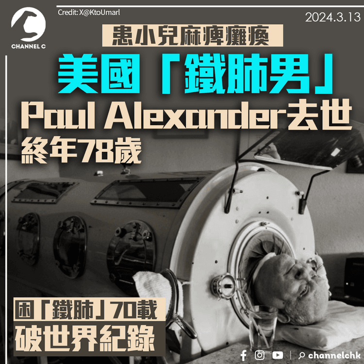 患病癱瘓困「鐵肺」70載破世界紀錄　美國Paul Alexander去世　終年78歲
