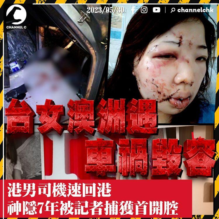 澳洲Working Holiday車禍 台灣女縫200針毀容 7年來如活在地獄 只盼港男司機一句道歉