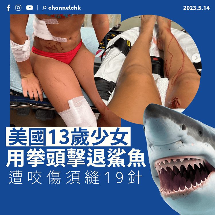 美國13歲少女用拳頭擊退鯊魚 遭咬傷須縫19針